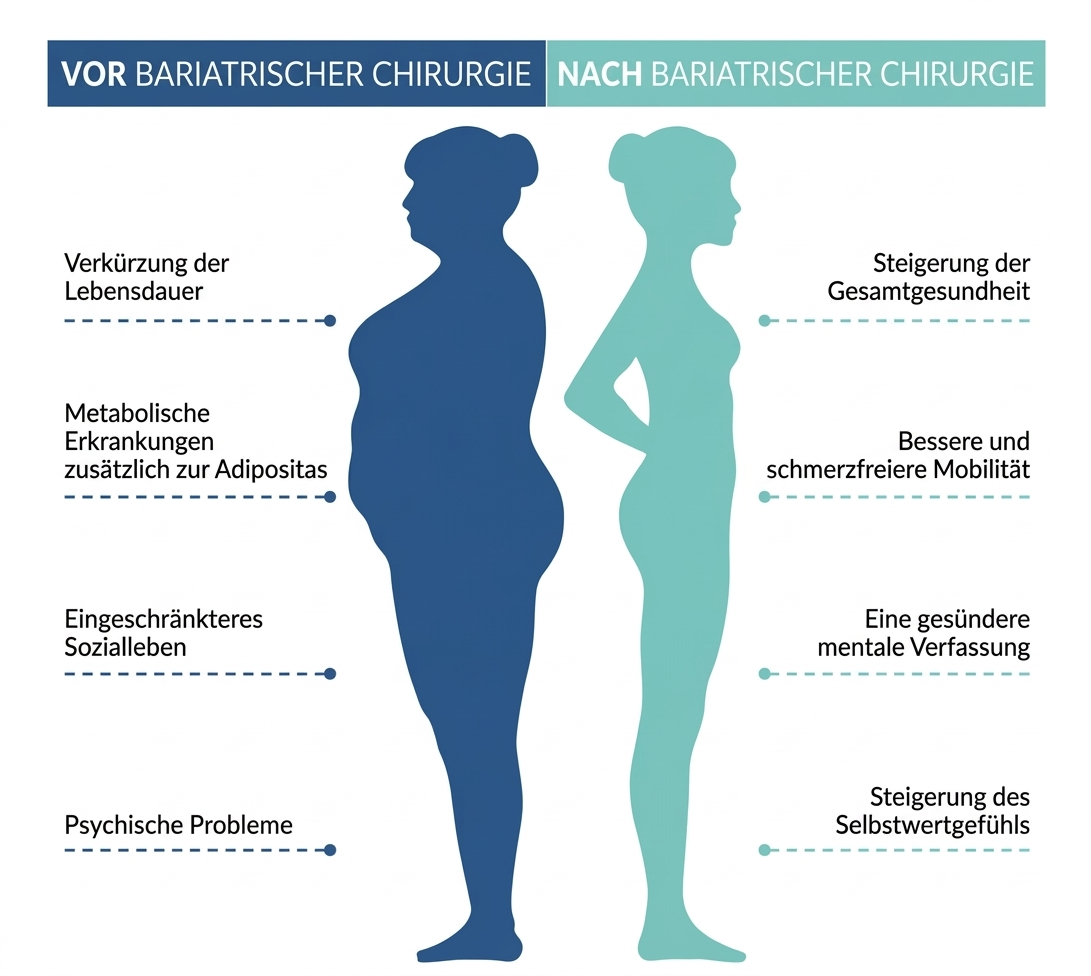Vor und nach bariatrischer Chirurgie: Risiken von Adipositas vs. Nutzen der Behandlung – Istanbul Hospital