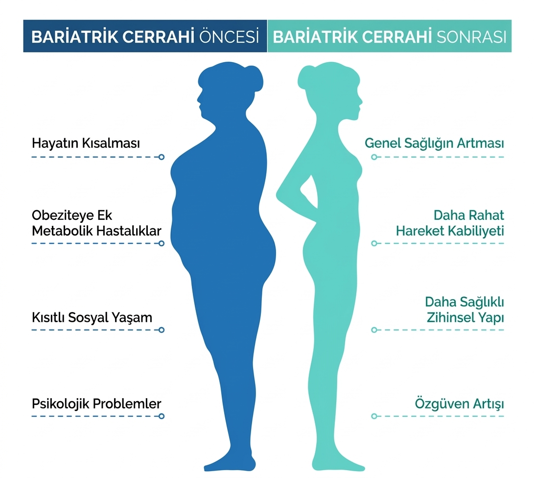 Bariatrik cerrahi öncesi ve sonrası: obezitenin riskleri ve tedavinin faydaları – İstanbul Hastanesi
