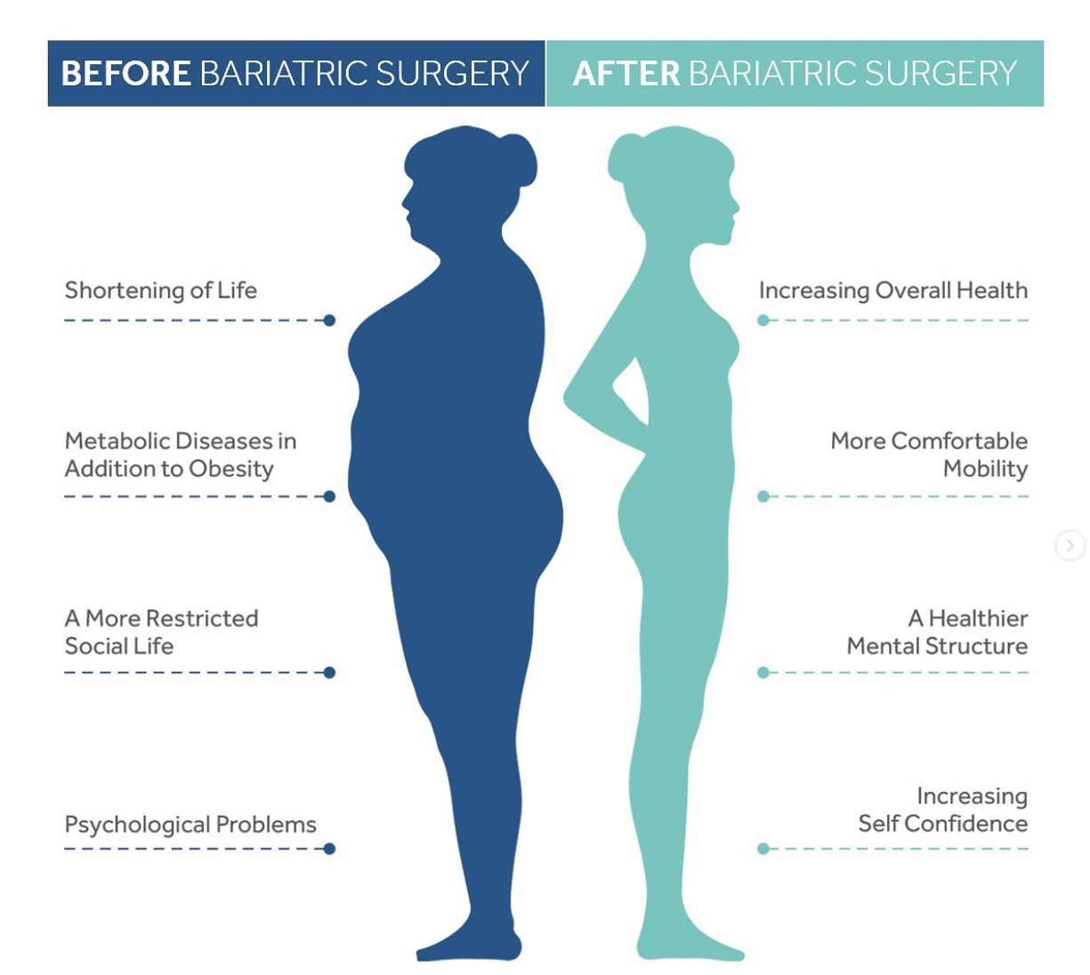 Before and after bariatric surgery: risks of obesity versus benefits of treatment – Istanbul Hospital